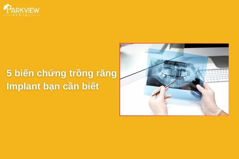 biến chứng trồng răng implant