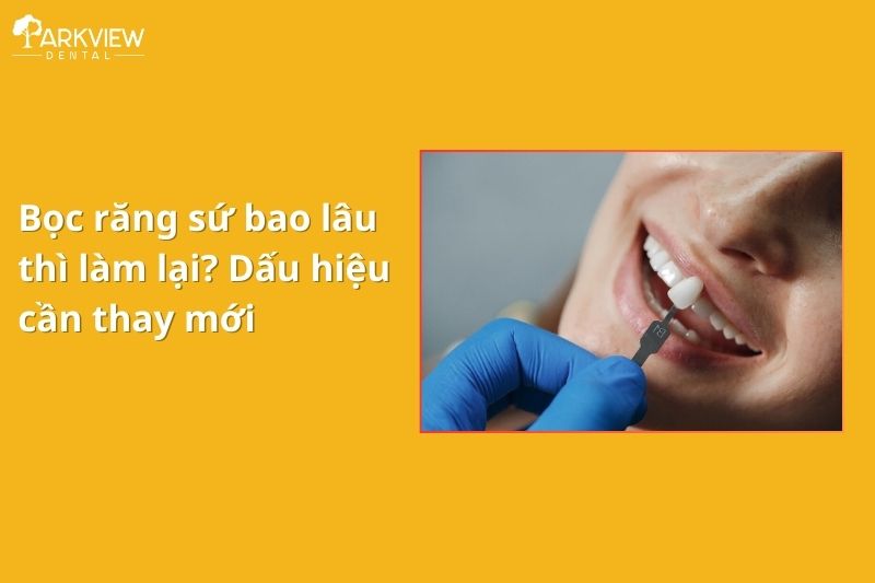 bọc răng sứ bao lâu thì phải làm lại