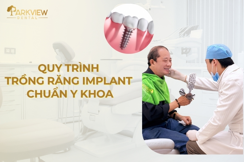 quy trình trồng răng implant