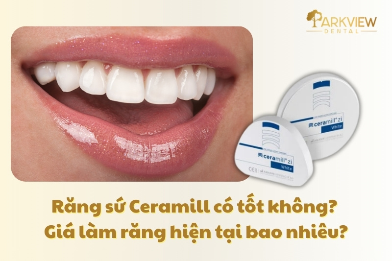 răng sứ ceramill