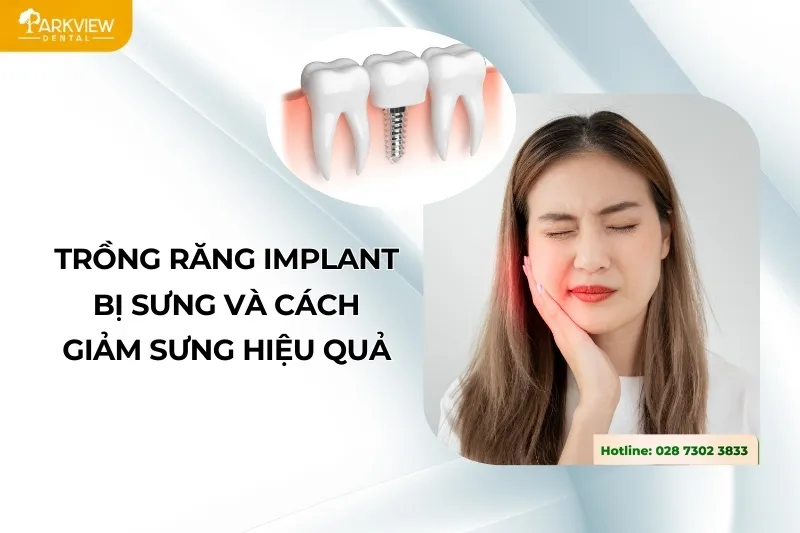 Trồng Răng Implant Bị Sưng Và Cách Giảm Sưng Hiệu Quả