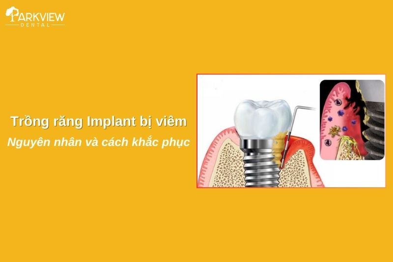 trồng răng implant bị viêm