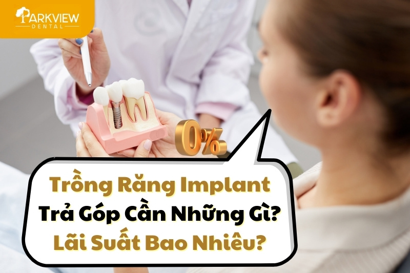 trồng răng implant trả góp